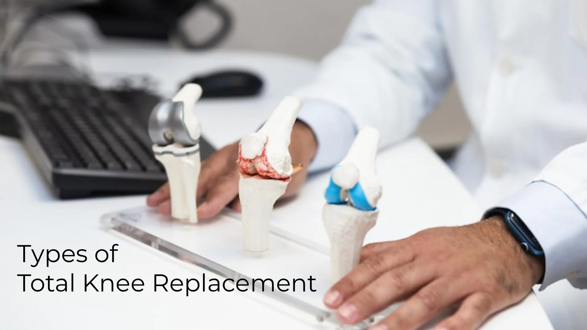 Types of Total Knee Replacement: A Complete Patient Guide (2026)