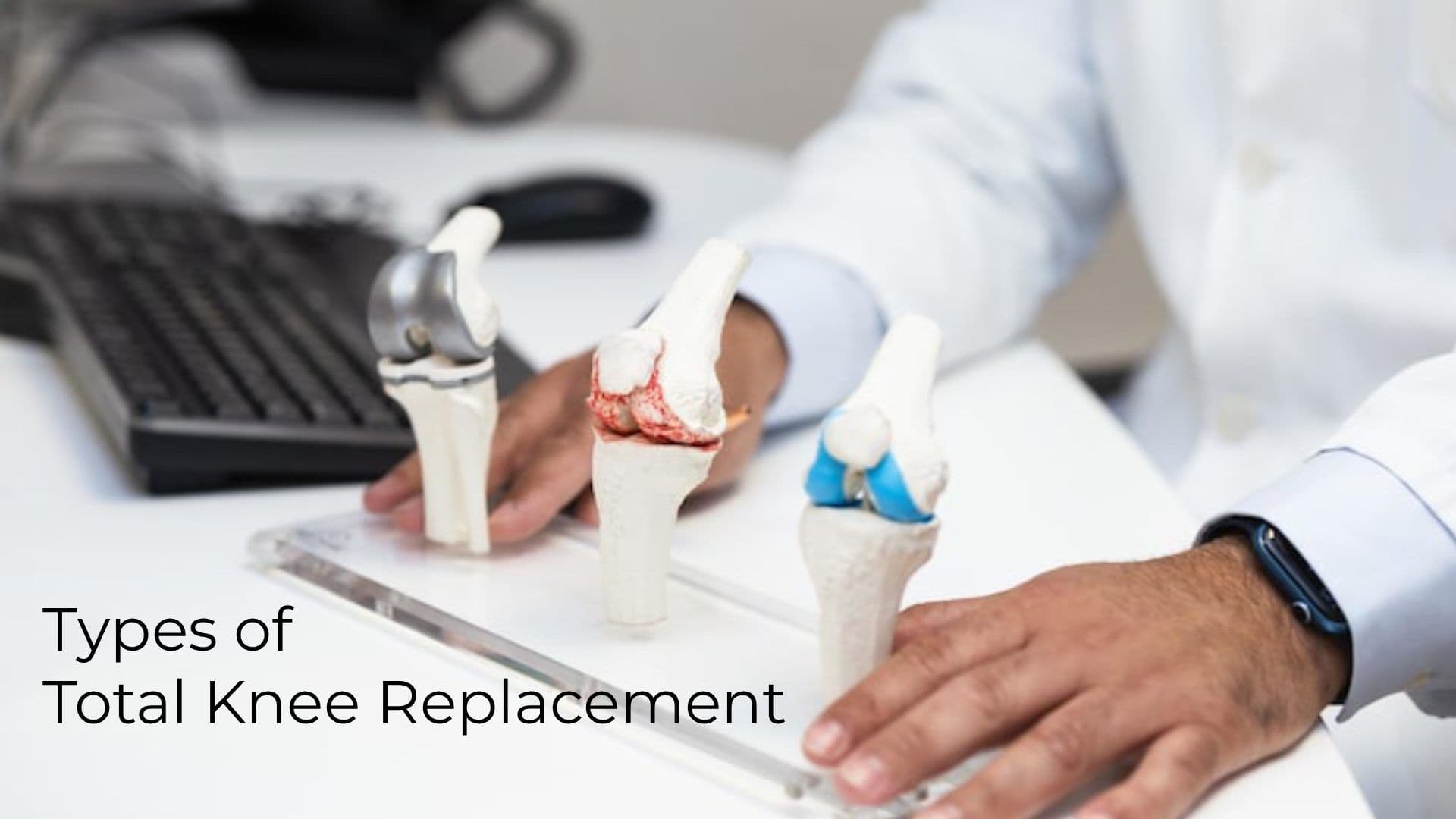 Types of Total Knee Replacement: A Complete Patient Guide (2026)